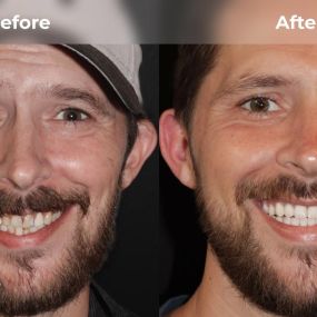 Bild von Smile Now Tri-Cities Dentures and Implants