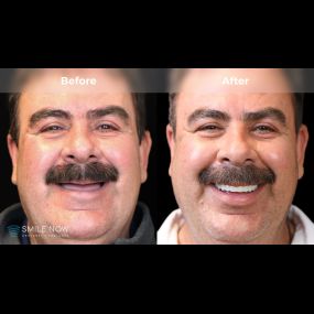 Bild von Smile Now Tri-Cities Dentures and Implants