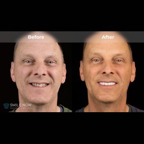 Bild von Smile Now Tri-Cities Dentures and Implants