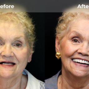 Bild von Smile Now Tri-Cities Dentures and Implants