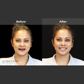 Bild von Smile Now Tri-Cities Dentures and Implants