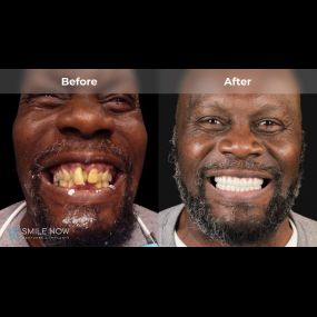 Bild von Smile Now Tri-Cities Dentures and Implants