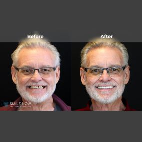 Bild von Smile Now Tri-Cities Dentures and Implants