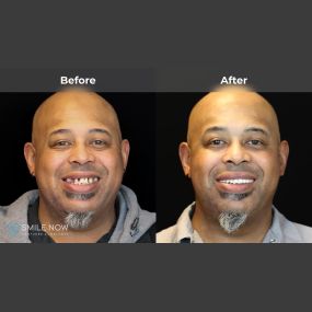 Bild von Smile Now Tri-Cities Dentures and Implants