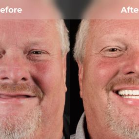 Bild von Smile Now Tri-Cities Dentures and Implants