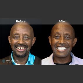 Bild von Smile Now Tri-Cities Dentures and Implants