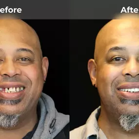 Bild von Smile Now Tri-Cities Dentures and Implants