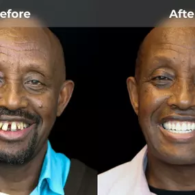 Bild von Smile Now Tri-Cities Dentures and Implants