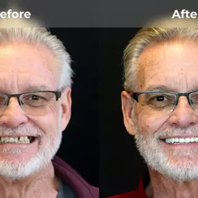 Bild von Smile Now Tri-Cities Dentures and Implants