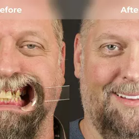 Bild von Smile Now Tri-Cities Dentures and Implants