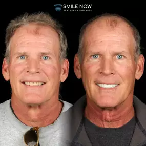 Bild von Smile Now Tri-Cities Dentures and Implants