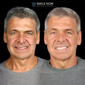 Bild von Smile Now Tri-Cities Dentures and Implants