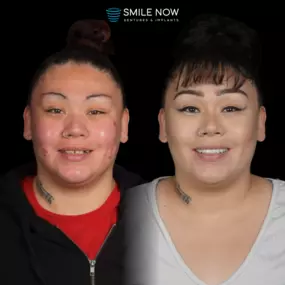 Bild von Smile Now Tri-Cities Dentures and Implants