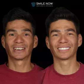Bild von Smile Now Tri-Cities Dentures and Implants