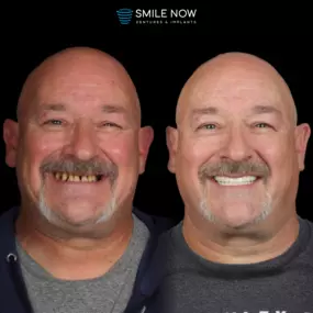 Bild von Smile Now Tri-Cities Dentures and Implants