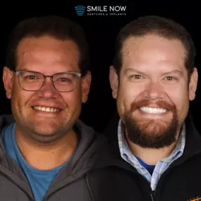 Bild von Smile Now Tri-Cities Dentures and Implants