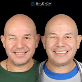 Bild von Smile Now Tri-Cities Dentures and Implants
