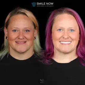 Bild von Smile Now Tri-Cities Dentures and Implants