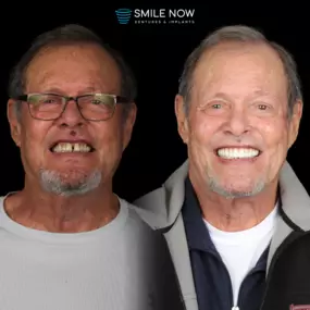 Bild von Smile Now Tri-Cities Dentures and Implants