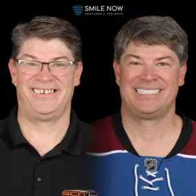 Bild von Smile Now Tri-Cities Dentures and Implants