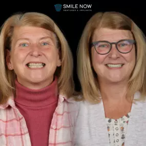 Bild von Smile Now Tri-Cities Dentures and Implants