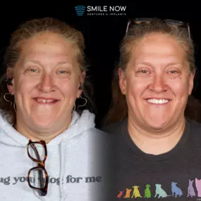 Bild von Smile Now Tri-Cities Dentures and Implants
