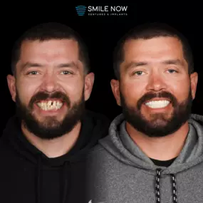 Bild von Smile Now Tri-Cities Dentures and Implants