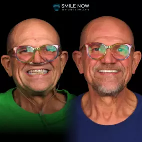 Bild von Smile Now Tri-Cities Dentures and Implants