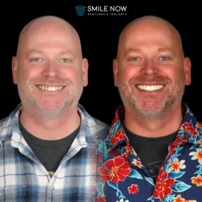 Bild von Smile Now Tri-Cities Dentures and Implants