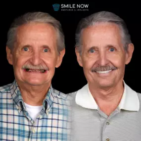 Bild von Smile Now Tri-Cities Dentures and Implants