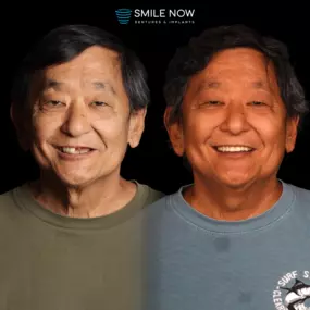 Bild von Smile Now Tri-Cities Dentures and Implants