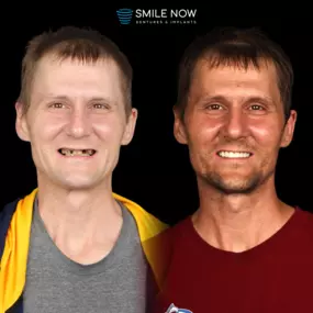 Bild von Smile Now Tri-Cities Dentures and Implants
