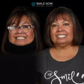 Bild von Smile Now Tri-Cities Dentures and Implants
