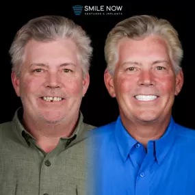 Bild von Smile Now Tri-Cities Dentures and Implants