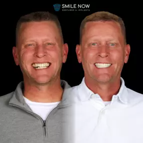 Bild von Smile Now Tri-Cities Dentures and Implants