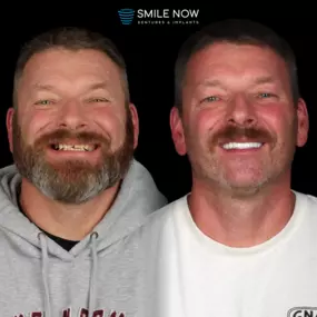 Bild von Smile Now Tri-Cities Dentures and Implants