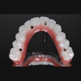 Bild von Florida Dental Implant Studio