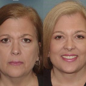 Bild von Facial Surgery Institute of Boca Raton