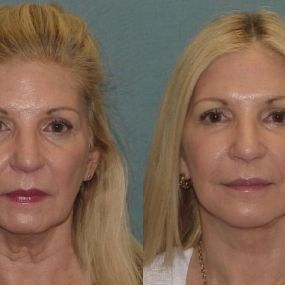 Bild von Facial Surgery Institute of Boca Raton