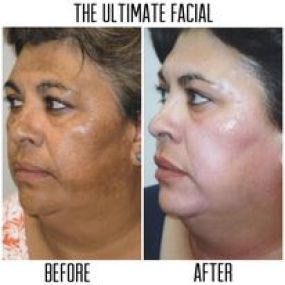 Bild von The Ultimate Facial