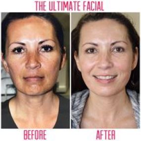 Bild von The Ultimate Facial