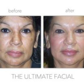 Bild von The Ultimate Facial