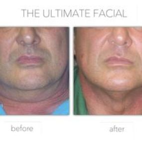 Bild von The Ultimate Facial