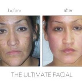 Bild von The Ultimate Facial