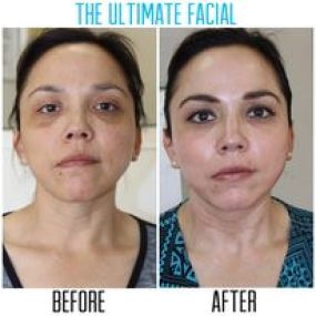 Bild von The Ultimate Facial