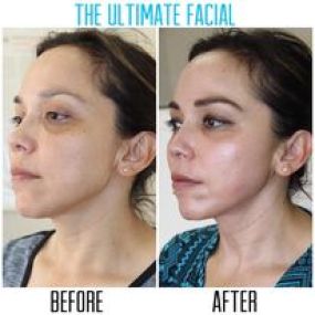 Bild von The Ultimate Facial