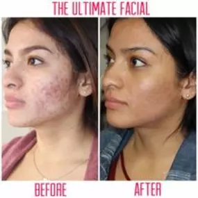 Bild von The Ultimate Facial