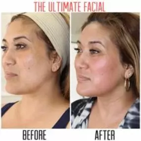 Bild von The Ultimate Facial