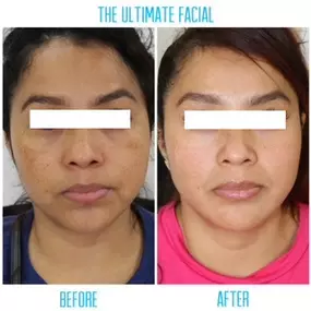 Bild von The Ultimate Facial