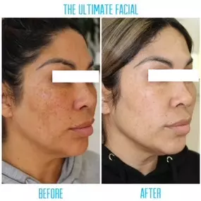 Bild von The Ultimate Facial